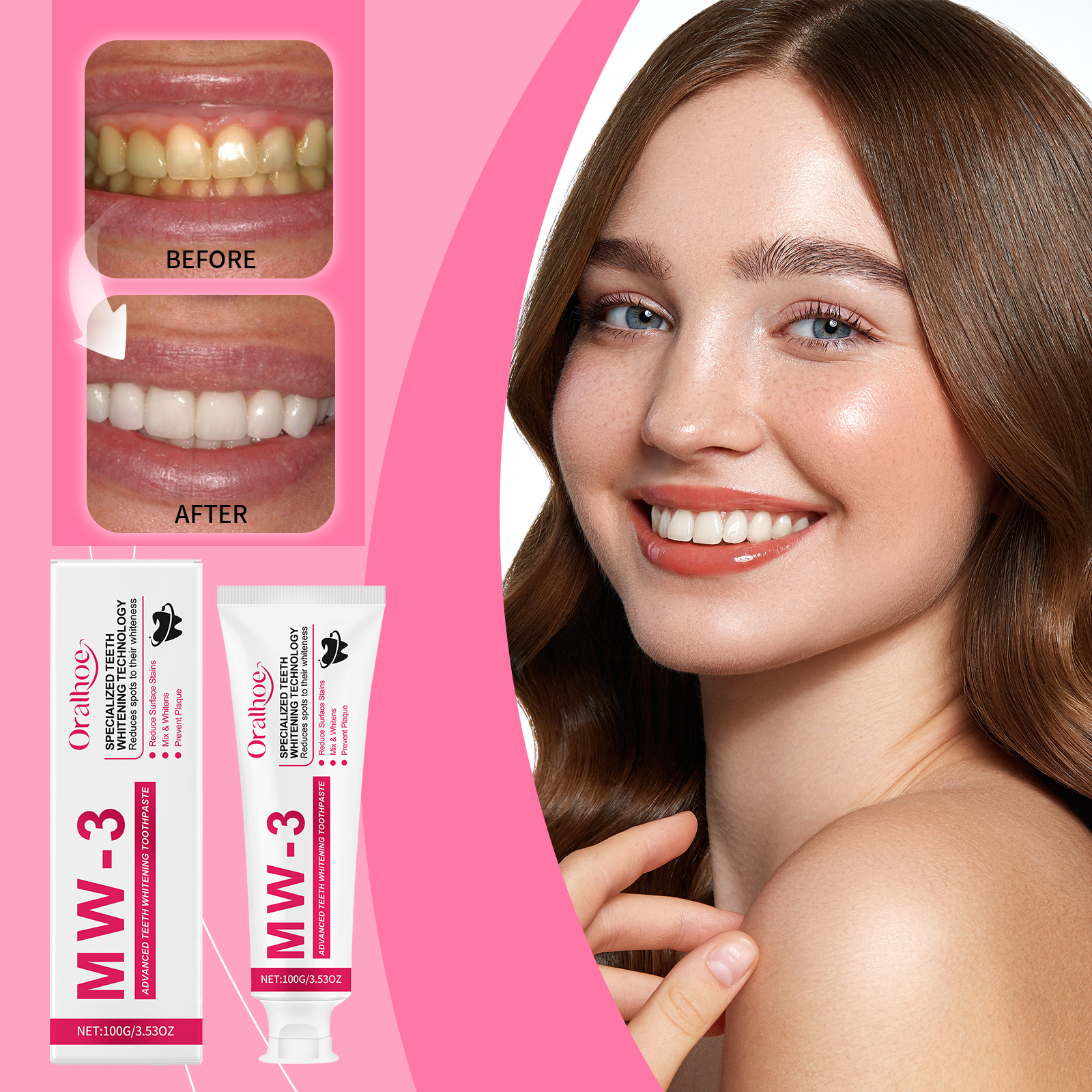 ORALHOE Advanced Teeth Whiteni - Teeth Whitening Or Tooth Whitening review and price