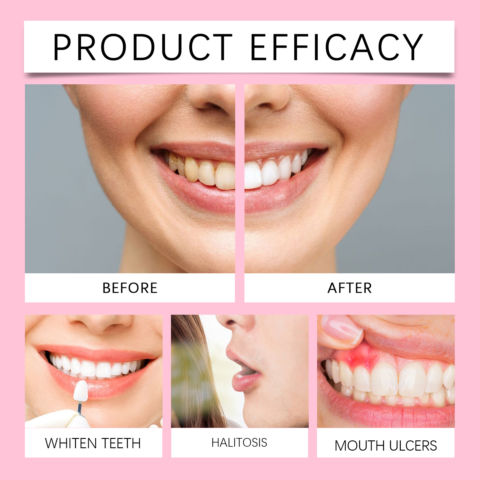 ORALHOE Advanced Teeth Whiteni - Teeth Whitening Or Tooth Whitening review and price