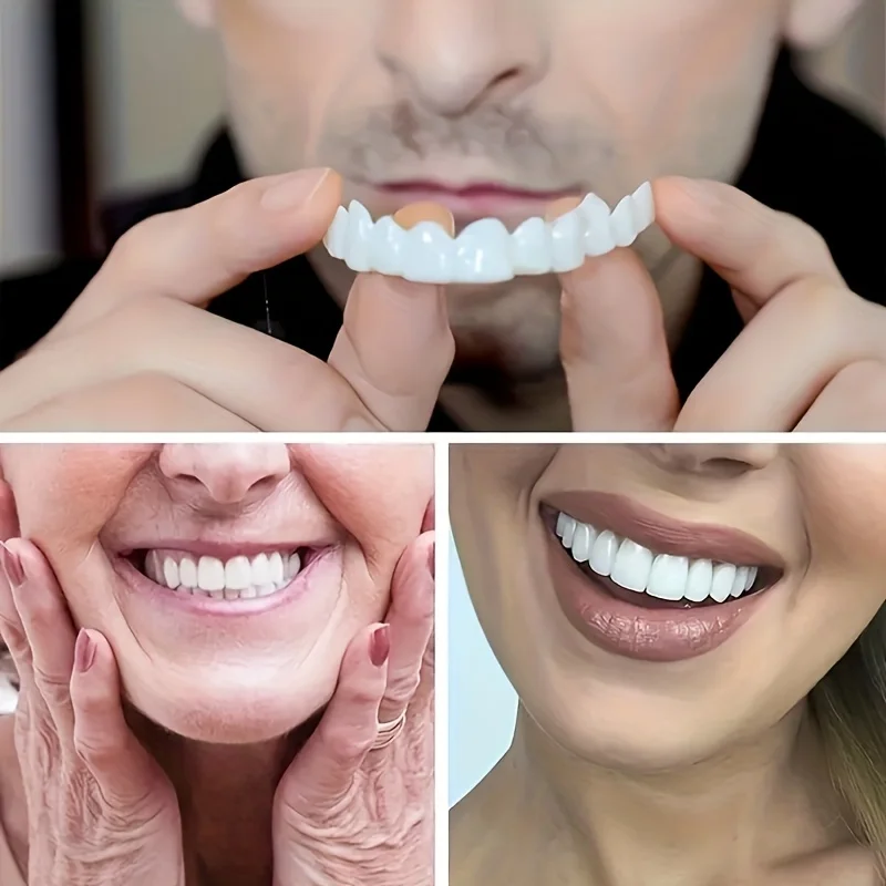 Color Matching Natural Teeth V - Teeth Whitening Options review and price
