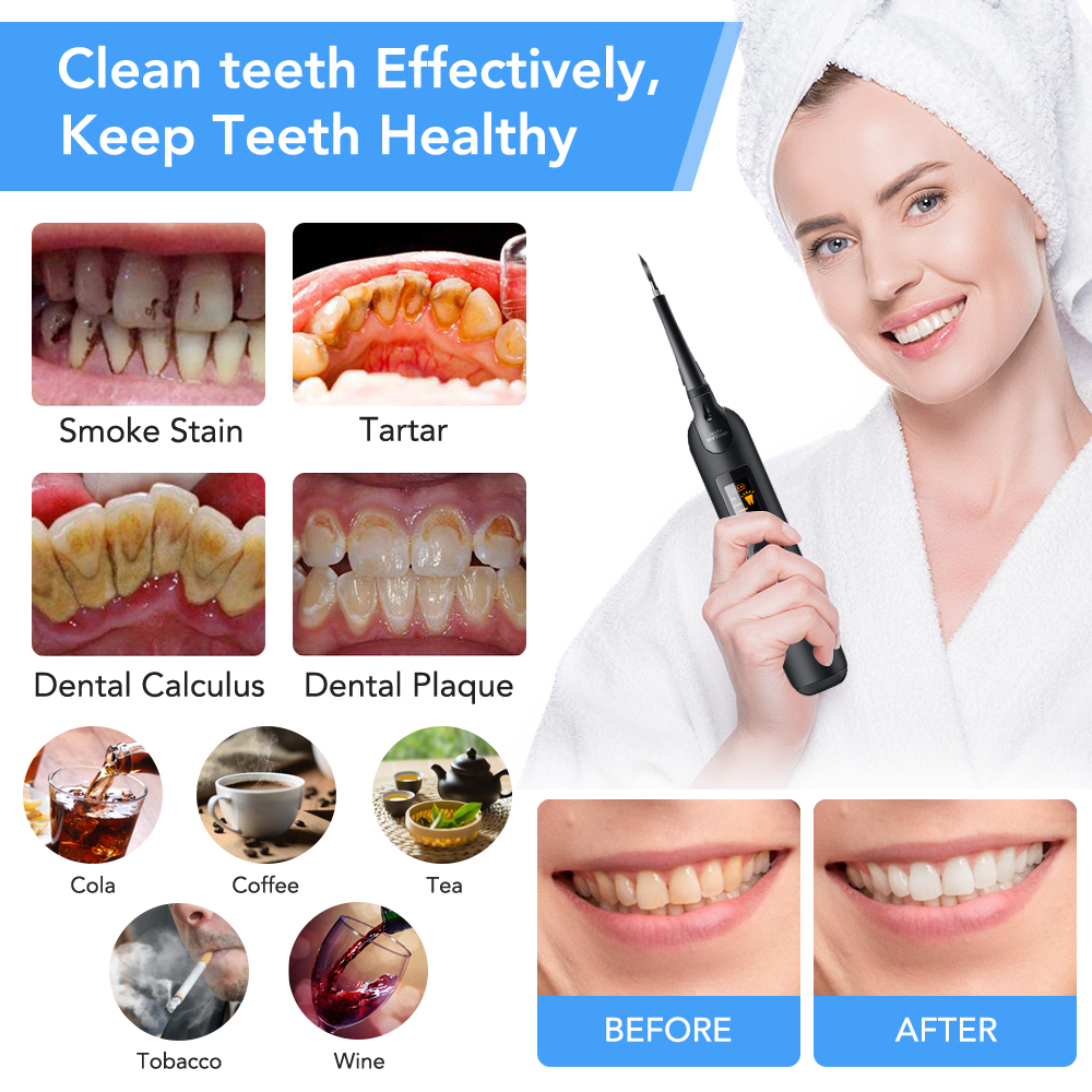 Teeth Tartar Remover Electric  - Teeth Whitening At Home review and price