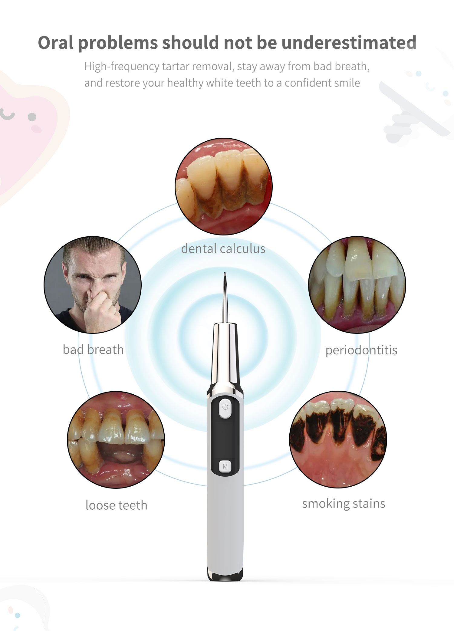 Electric Sonic Dental Calculus - Teeth Whitening Or Tooth Whitening review and price