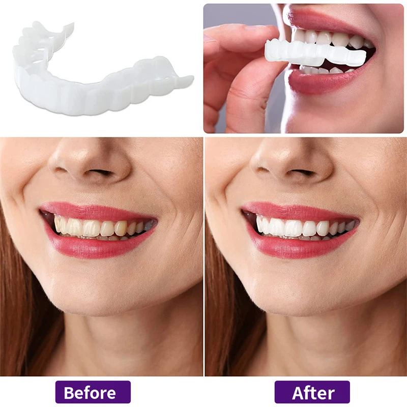 Color Matching Natural Teeth V - Teeth Whitening Options review and price