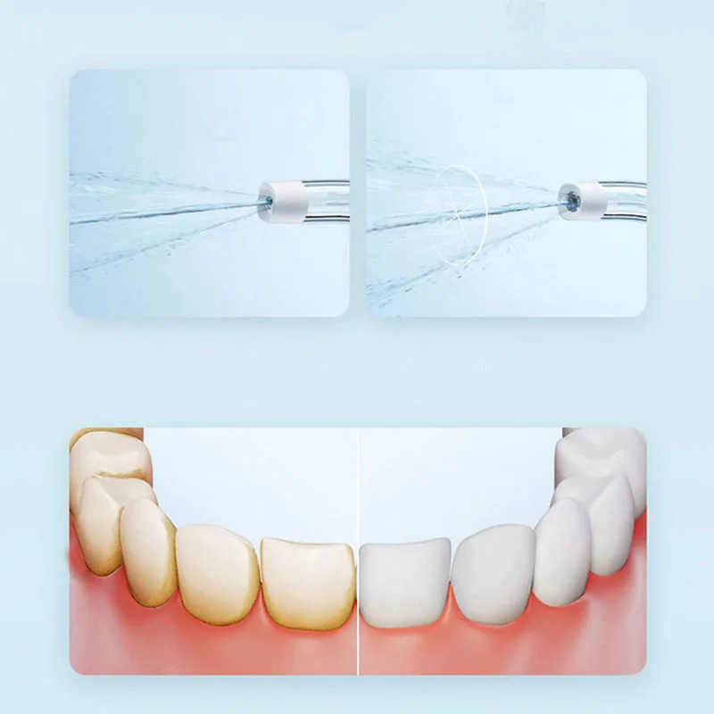 Xiaomi Portable Oral Irrigator - Teeth Whitening Or Tooth Whitening review and price