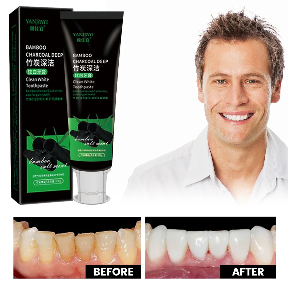 110g Bamboo Charcoal Black Too - Teeth Whitening Charcoal review and price