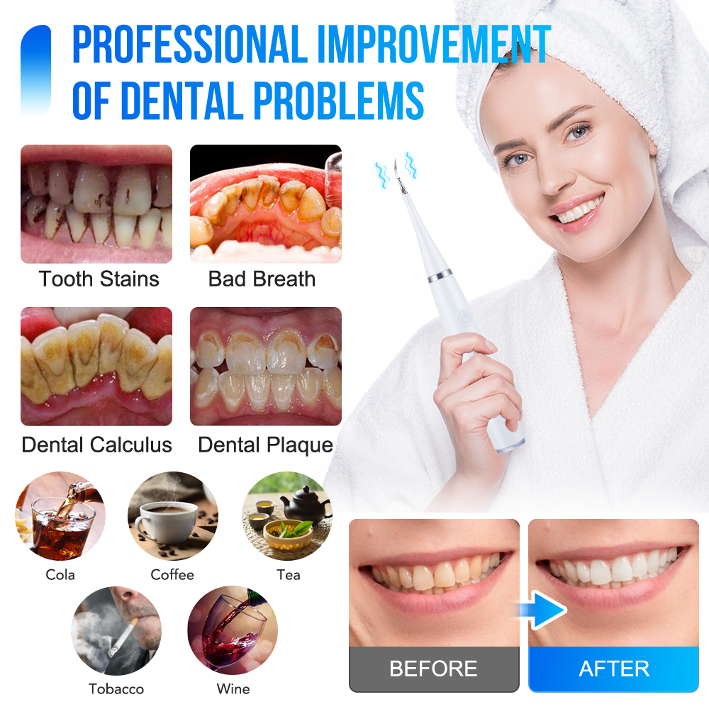 Household Electric Teeth Clean - Teeth Whitening Or Tooth Whitening review and price