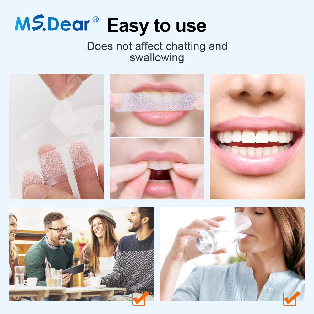 Teeth Whitening Strips Cleansi - Teeth Whitening App review and price